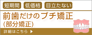 前歯だけのプチ矯正(部分矯正)|詳しくはこちら