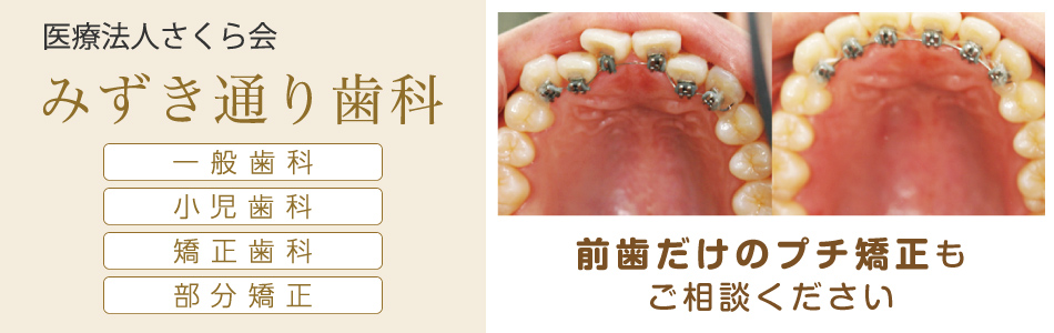 前歯だけのプチ矯正も行っております。